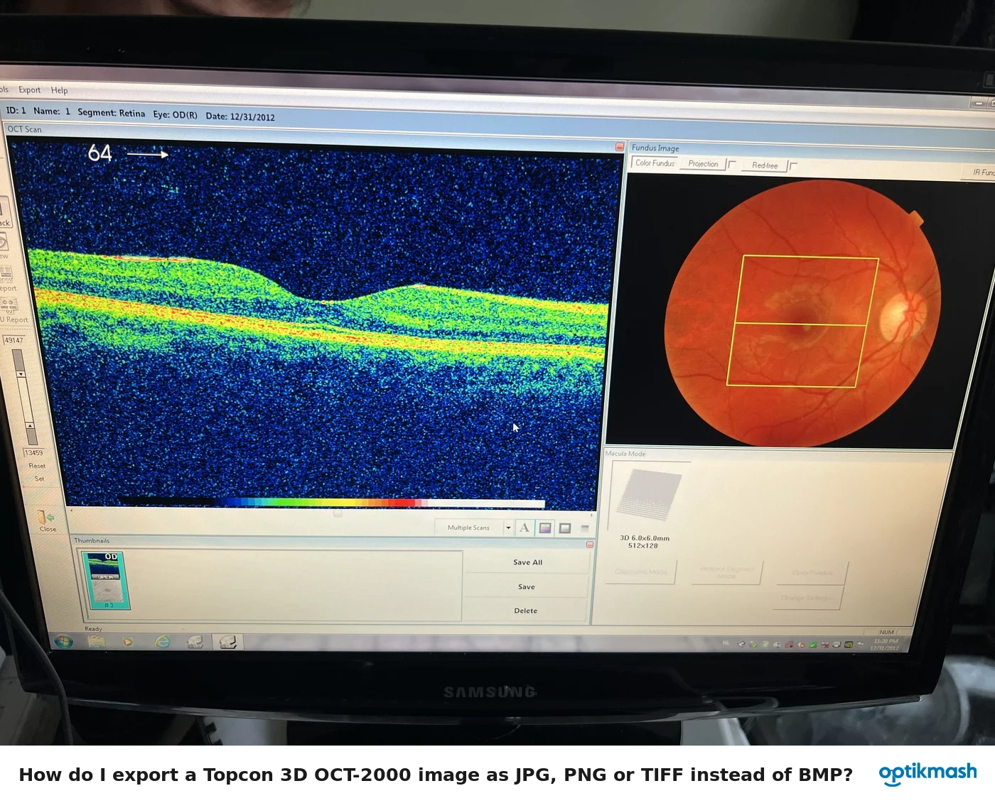 How do I export a Topcon 3D OCT-2000 image as JPG, PNG or TIFF instead of BMP?