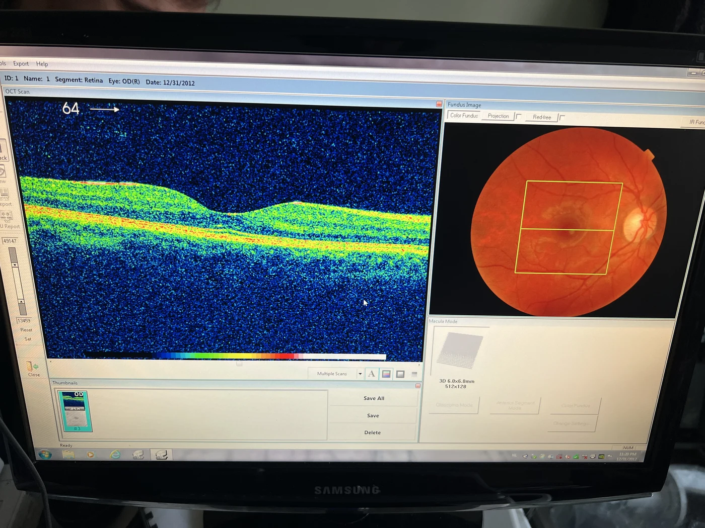 How do I export a Topcon 3D OCT-2000 image as JPG, PNG or TIFF instead of BMP?